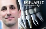Dentysta Wrocław - implanty zębowe